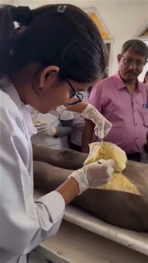 dissection of femoral triangle #femoral triangle #anatomy #dissection #college #medical