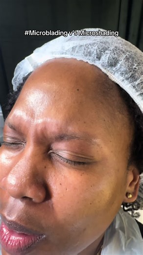 #creatorsearchinsights ✨ Microblading vs. Microshading – Which is Better? ✨ While both techniques enhance your brows, microblading reigns supreme for that natural, hair-like look! Microshading gives a soft, powdered effect, but if you want crisp, defined strokes that mimic real hair, microblading is the ultimate game-changer. Wake up every day with effortlessly perfect brows! 💕 #Microblading #BestBrows #NaturalBrowLook #BrowPerfection #FlawlessBrows #WakeUpWithMakeup #SemiPermanentMakeup #BrowG