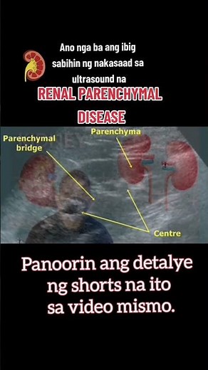 Renal Parenchymal Disease