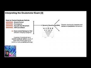 Oculomotor Exam - Central Deficits | Interpretation & Treatment Selection