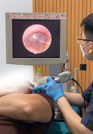 Cứ 2-3 ngày là ngoáy tai 1 lần, anh bệnh nhân khá bất ngờ khi thấy tai mình có khối ráy tai to như vậy. #raytai #layraytai #layraytainoisoi #phongkhamtaimuihong #doctoranh