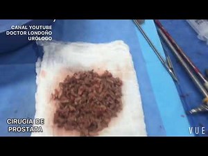 CIRUGÍA DE PRÓSTATA