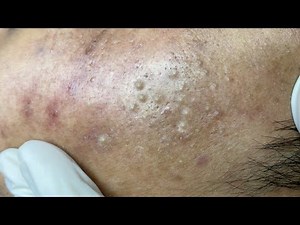 Relax Every Day With Sac Dep Spa #0256