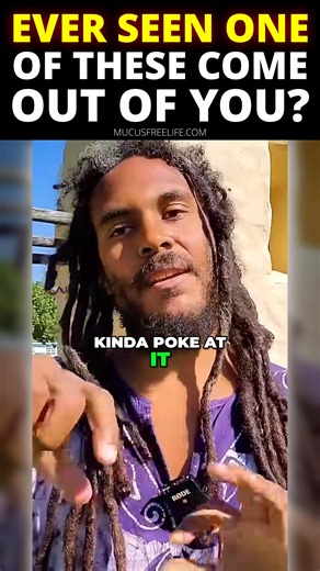 It might look like a shoestring—but it’s not from your closet. 👀 That slimy stringy “stuff” leaving the body? That’s mucoid plaque—waste your system’s been holding for years. The cleaner you eat, the more comes out. 👉 Follow Prof. Spira for daily mucus-free truth and vitality. | Prof. Spira