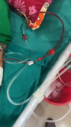 hemodialysis kidney disease chronic kidney disease stage 5 with me only the last stage I have 🥺😢 #hemodialysis #bigproblem #death #laststageoflife