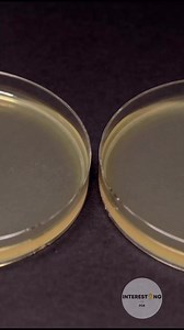 6.2K views · 38 reactions | This is why you should was your hands! Amazing bacteria time lapse! | Interesting as FCK | Facebook