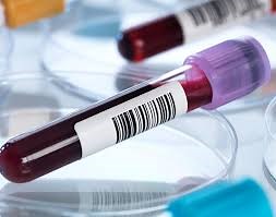 What is CBC Test , FBC, CP Normal Range, Clinical Significance