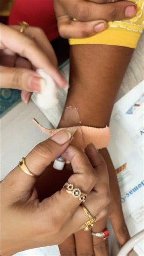 How to remove IV cannula