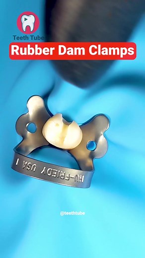 Rubber Dam Clamps in Dental Work: A Comprehensive Guide