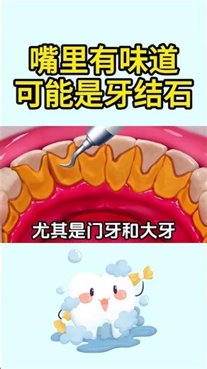 Does dental calculus make your mouth taste bad #dentist #teethdecay