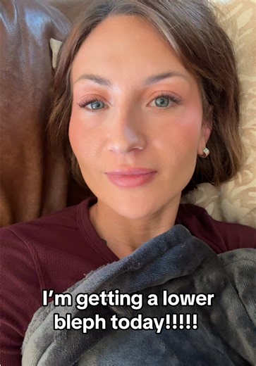 #lowerbleph #undereyesurgery #bleph #cosmeticsurgery #coloradosprings | lower bleph