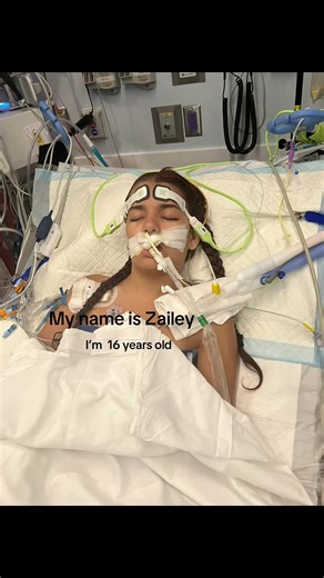 This is just the beginning, I still have a long way to go. Like and share to help fundraise my recovery #strokesurvivor #avmrupture #avmawareness #strokerecovery