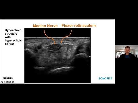 Webinar: Ultrasound-guided Peripheral Nerve Hydrodissection