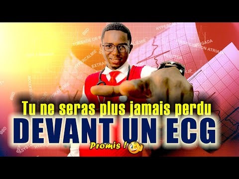 La MEILLEURE vidéo pour comprendre enfin l'ECG (le secret pour maitriser)