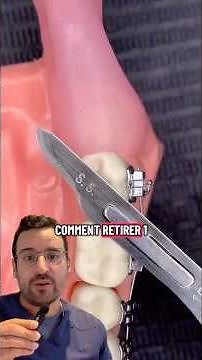 L’anatomie et les risques liés à l’extraction des dents de sagesse : ce qu’il faut savoir !