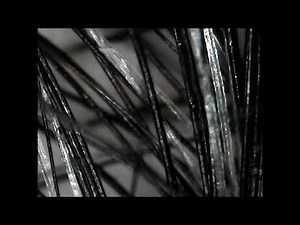 Oily Greasy Hair under the Microscope