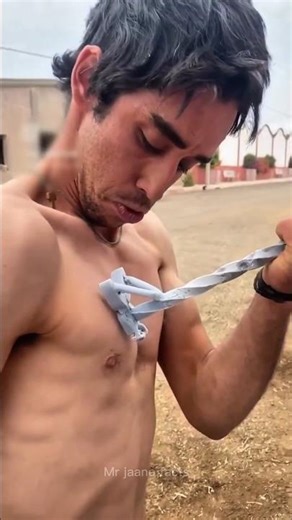 The Truth About Freeze Branding on Skin? #shorts