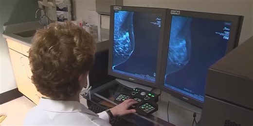 New FDA guidelines for mammogram reports now in effect