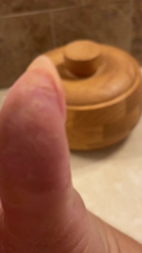 Tiny cut from cracking #parmeseanpalms #skinpicking #callousremoval #dermatillomania #dermatophagia #dermatology