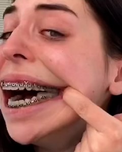 48K views · 265 reactions | This girl made an amazing recovery after her jaw surgery  | Lessons Learned In Life | Facebook