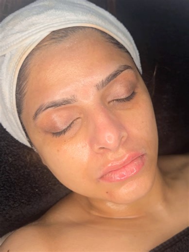 If your skin feels dry, dull or tired, this treatment is for you ✨ The Visopeel exfoliates and refreshes the skin, while a hyaluronic acid infusion restores hydration for a soft, radiant finish. #Visopeel #newcastle #glassskinfacial #HealthySkin #HydratingFacial