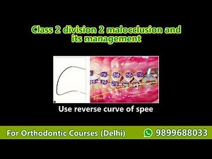 #orthodontics #treatment planning Part 4- Class 2 div 2 malocclusion, Orthodontic Courses Lecture