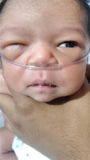 Oxygen Hungry Newborn Baby Crying Loudly 😭 | Normal Delivery Baby Active Moments 🥰 #Shorts #crypto