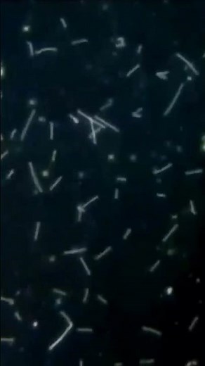 Dark field microscopy of Leptospirosis (Bacteria)