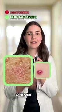 Harmless or Skin Cancer?
