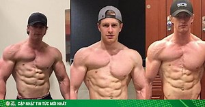 Nam lực sĩ “kỳ dị” nhất thế giới: Cơ bắp lực lưỡng nhưng chỉ có 1 ngực