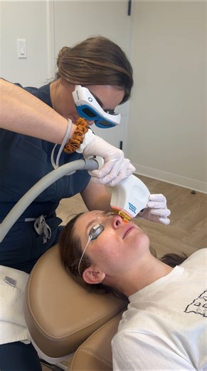 Sciton BBL Microneedling: a strategic pairing🩵 BBL improves tone, redness, and pigmentation at the cellular level, while microneedling enhances texture by stimulating collagen and elastin. Ideal for longtime patients looking to maintain and refine skin quality over time! • #skincare #medspa #scitonbbl #microneedling #prptreatment | Defy Aesthetic