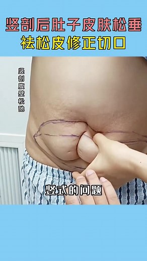 Understanding Surgical Procedures: A Close-Up View