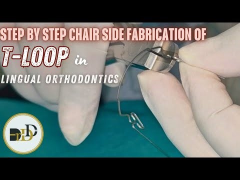 Live Chairside Demo: T-Loop Bending in Lingual Orthodontics l Step-by-step fabrication 