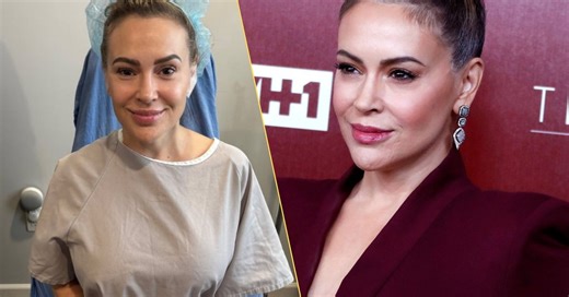 Alyssa Milano wyjęła implanty z niegdyś "wykorzystywanego" ciała. "Uwalniam się"
