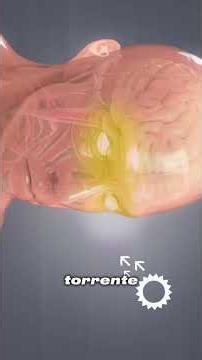 What is meningitis? #biology #medicine