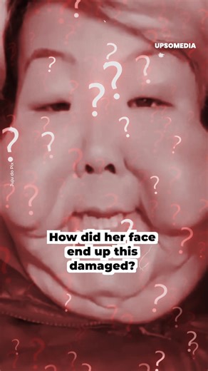 Juju do Pix was a beloved and well-known influencer in Brazil. A cosmetic procedure led her to a long struggle that today inspires many. What happened during that cosmetic procedure? | Know More