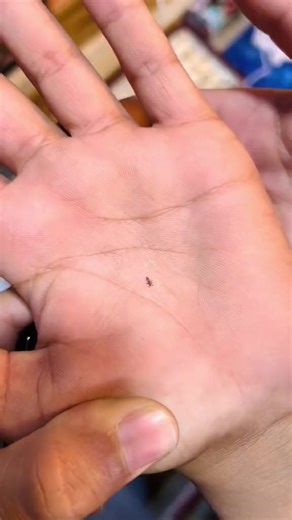 Flat 30% Off on V Comb Electronic Head Lice Removal Machine