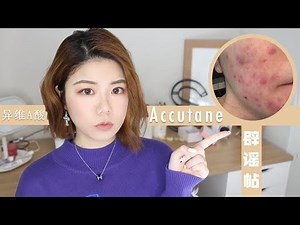停药了💊异维A酸真的那么可怕吗？亲身经验告诉你 • Accutane Experience | Sylvia黄瓜瓜