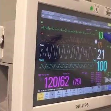 How to Zero an EVD & Measure ICP with Neurosurgeon & Nurse Xtina