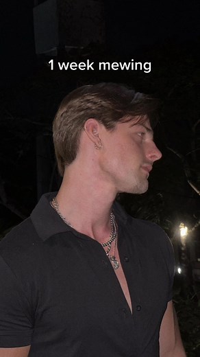 Mewing Transformation in One Week | Results and Progress