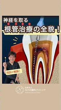 Introducing the full story of "root canal treatment" to remove nerves! #NakanoDental #OkayamaDent...