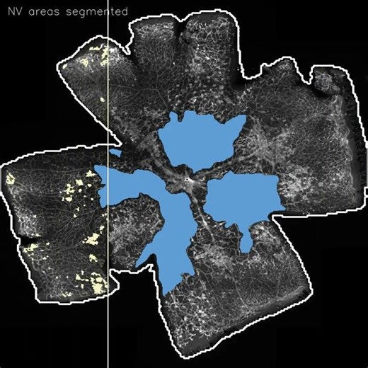Automated Segmentation of Mouse Retinal Flat Mount in an Oxygen-Induced Retinopathy Model #science