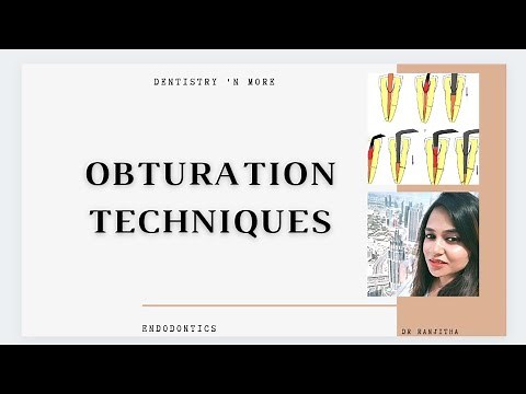 OBTURATION TECHNIQUES
