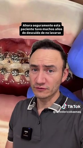 Ortodoncia y Salud Dental: Riesgos y Consecuencias