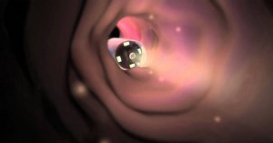 Ready to swallow a digital camera? - IEEE Future Directions