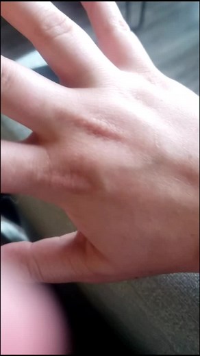 Hair Splinter Removal Tips for Groomers and Hairstylists