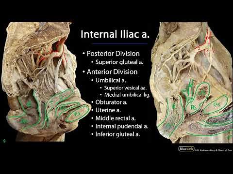Pelvic Vasculature M1 Perineum SDV