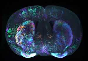 Seattle startup with fresh approach to Parkinson’s and Alzheimer’s disease raises $96M