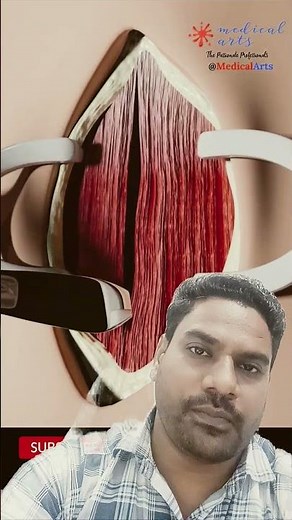 tracheostomy procedure step wise