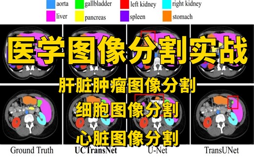 医学图像分割实战教程：肝脏肿瘤图像分割、心脏图像分割、细胞图像分割全详解！原理详解+项目实战，CV新手必学！